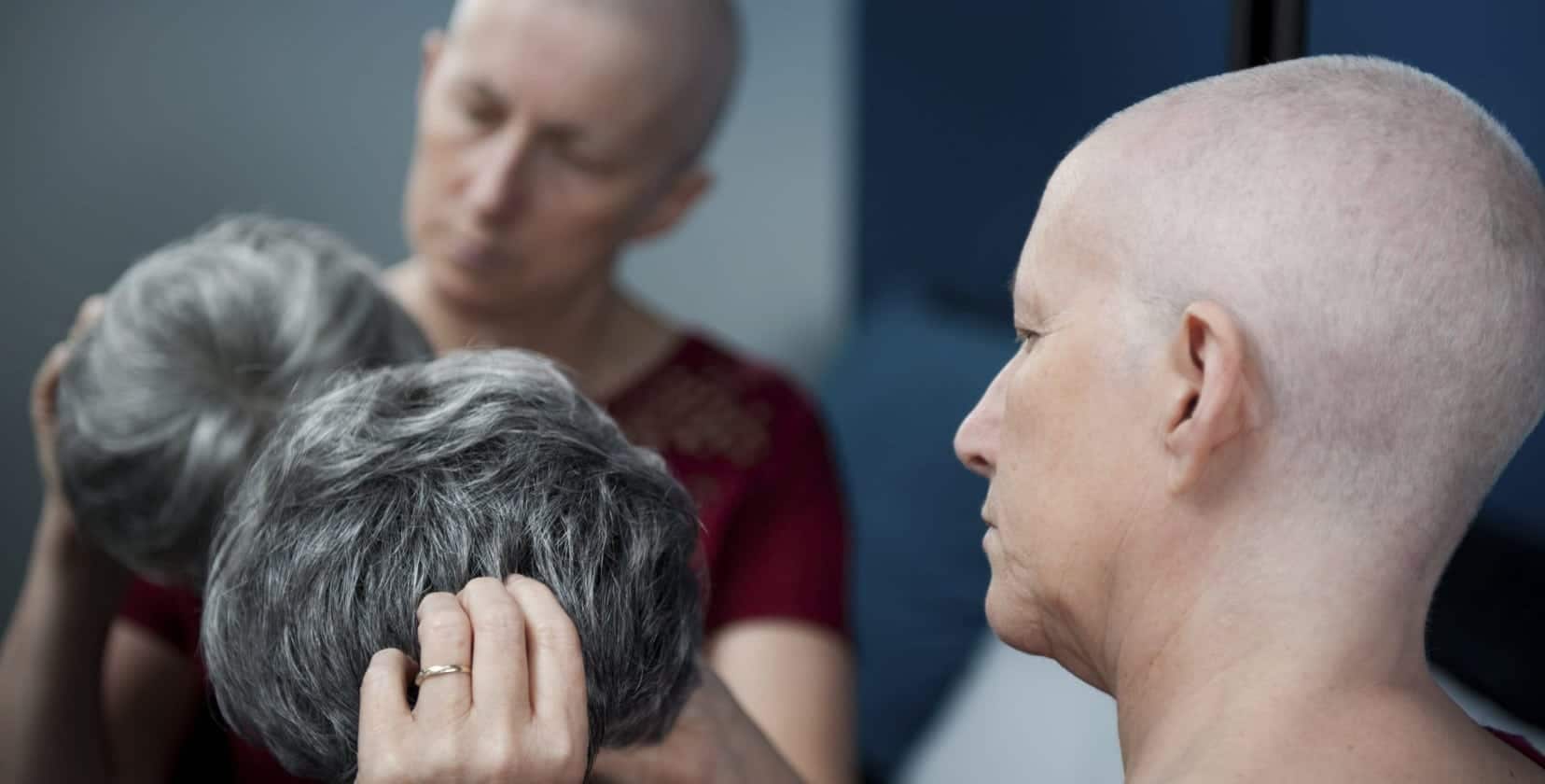 Permanent Hair Loss and Taxotere -Goldwater Law Firm