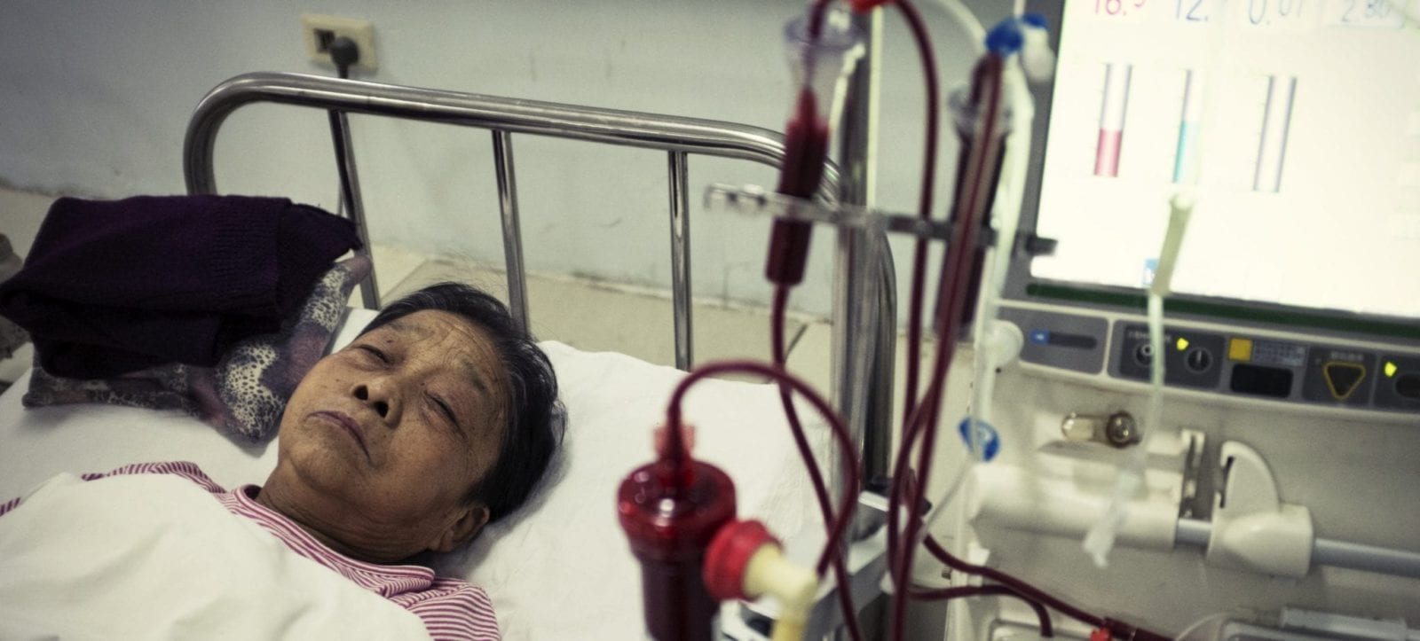 Heartburn Medication can cause severe kidney damage