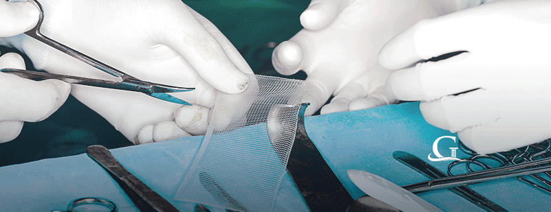 Two Doctors Cutting Hernia Mesh Stock Photo