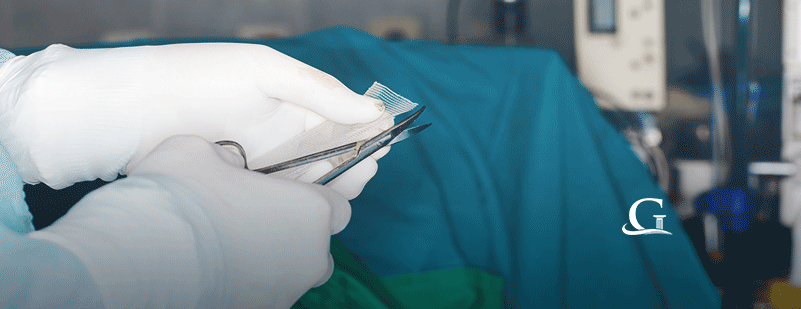 Doctor Cutting Hernia Mesh Stock Photo