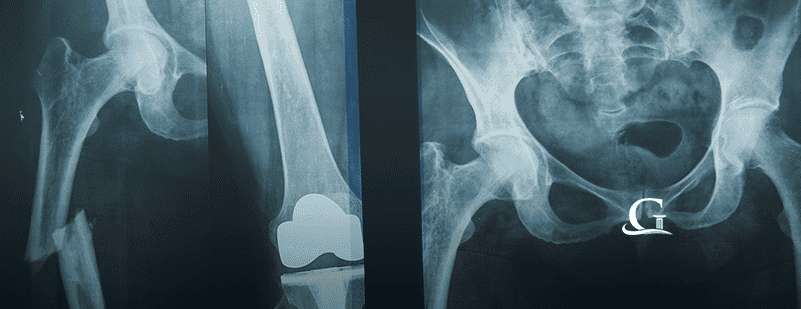 Medical X-ray Stock Photo