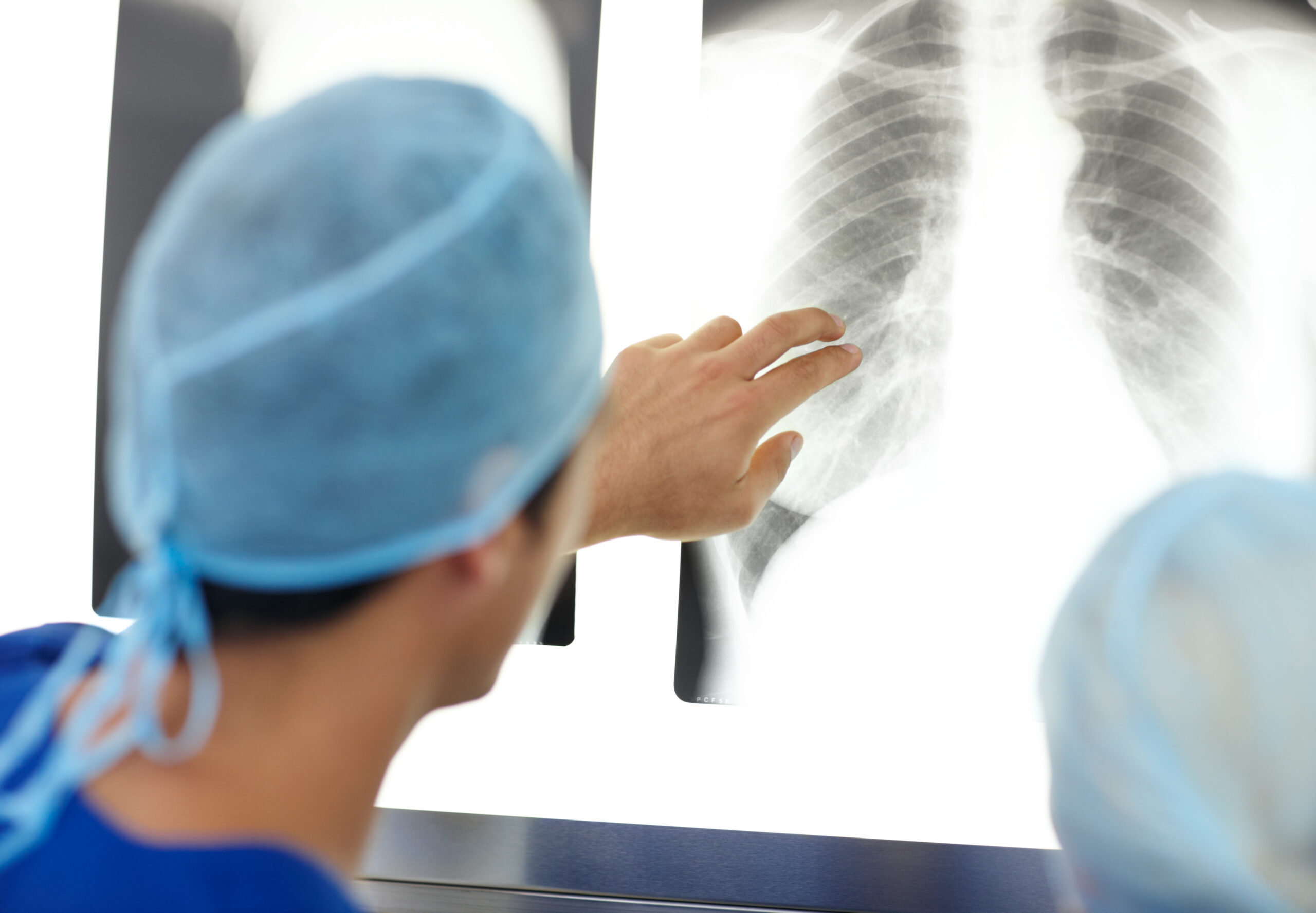 doctor-looking-closely-at-xray-of-lungs